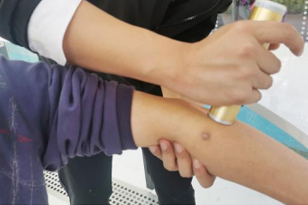 盆底運(yùn)動(dòng)康復(fù)